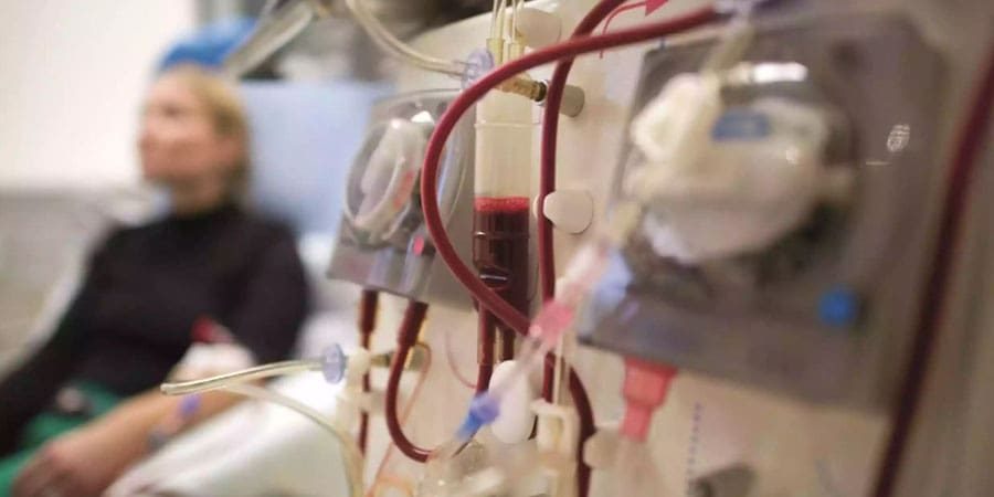 وحدة غسيل الكلى تعبيرية